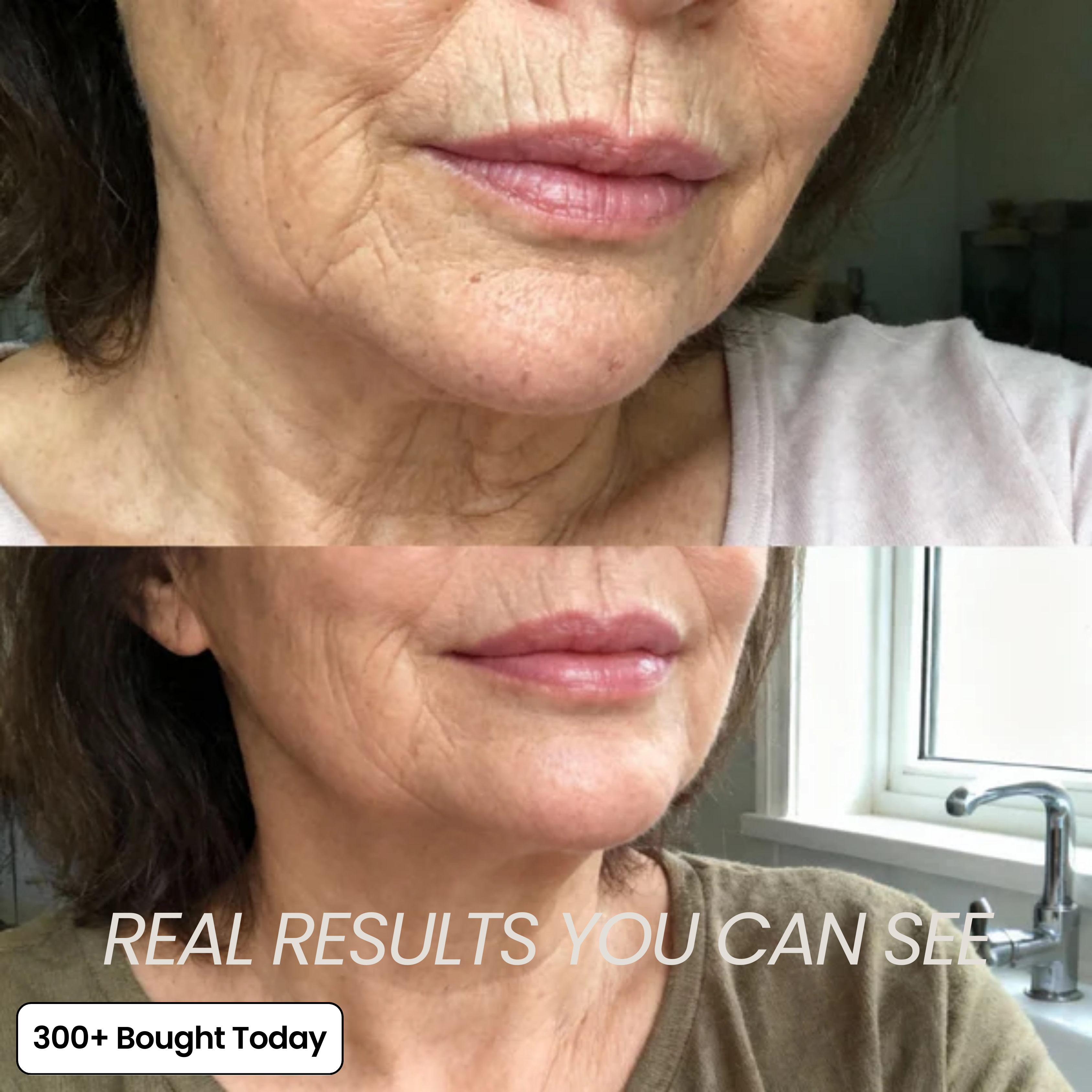 Wrinkle Smoothing Care – Youthful Glow Boost
