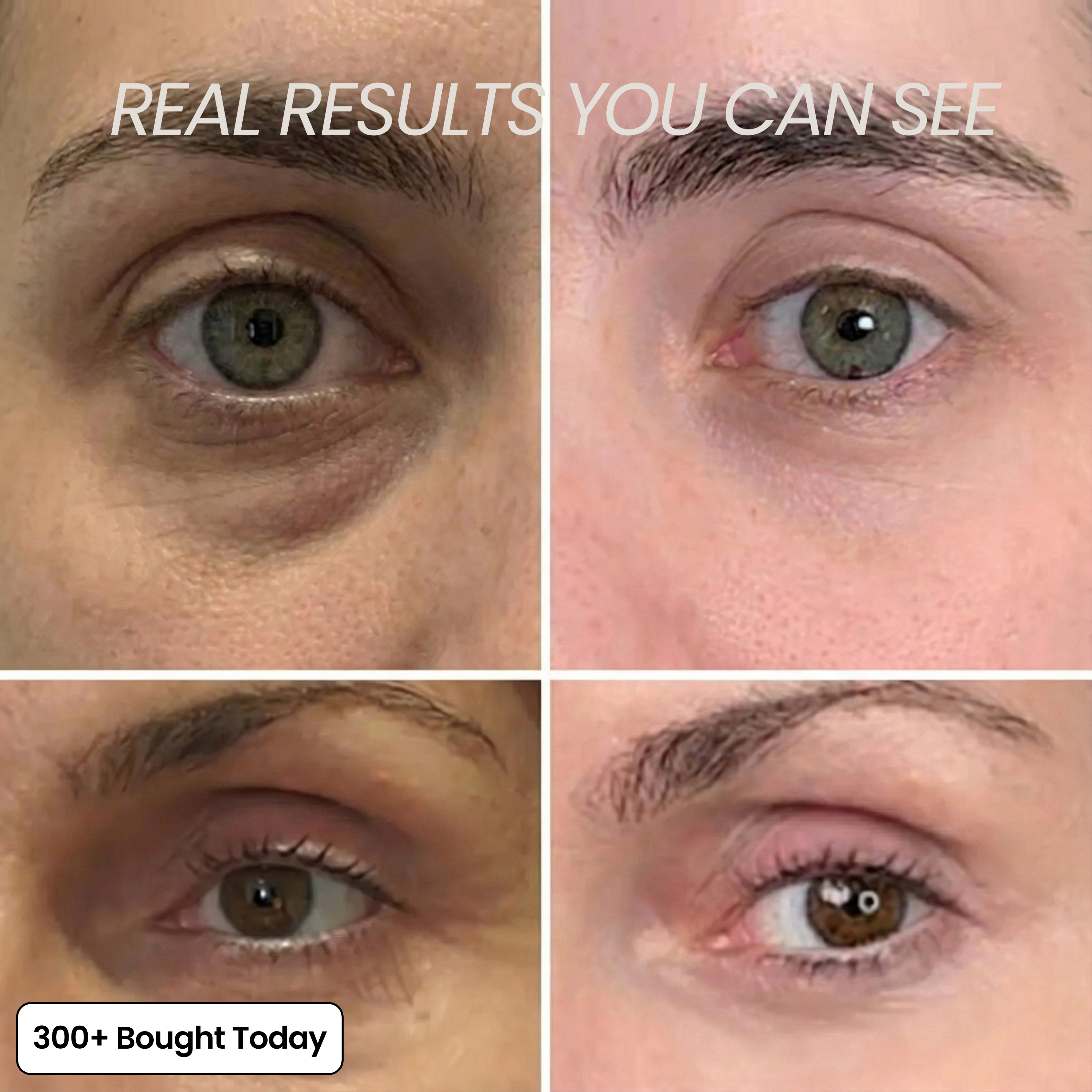 Wrinkle Smoothing Care – Youthful Glow Boost