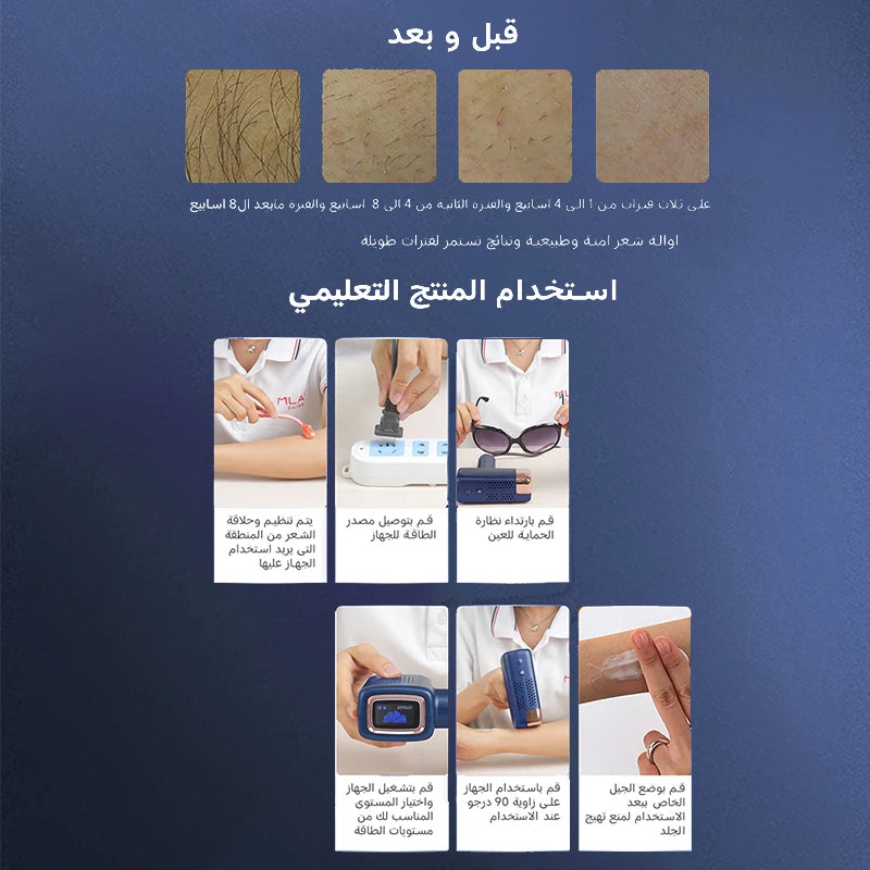 Ice Cooling IPL Device – Smooth Skin at Home