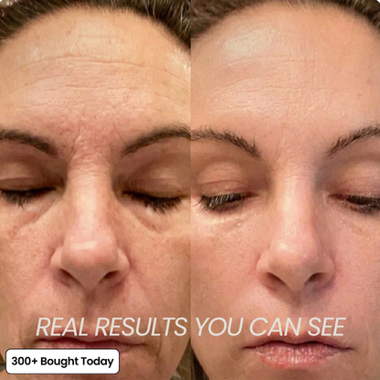 Wrinkle Smoothing Care – Youthful Glow Boost