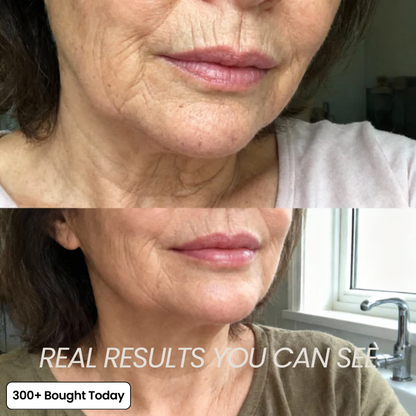 Wrinkle Smoothing Care – Youthful Glow Boost