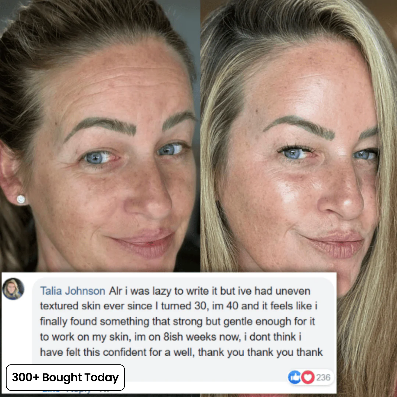 Wrinkle Smoothing Care – Youthful Glow Boost