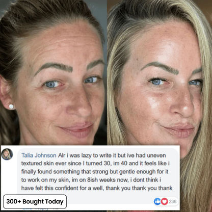 Wrinkle Smoothing Care – Youthful Glow Boost