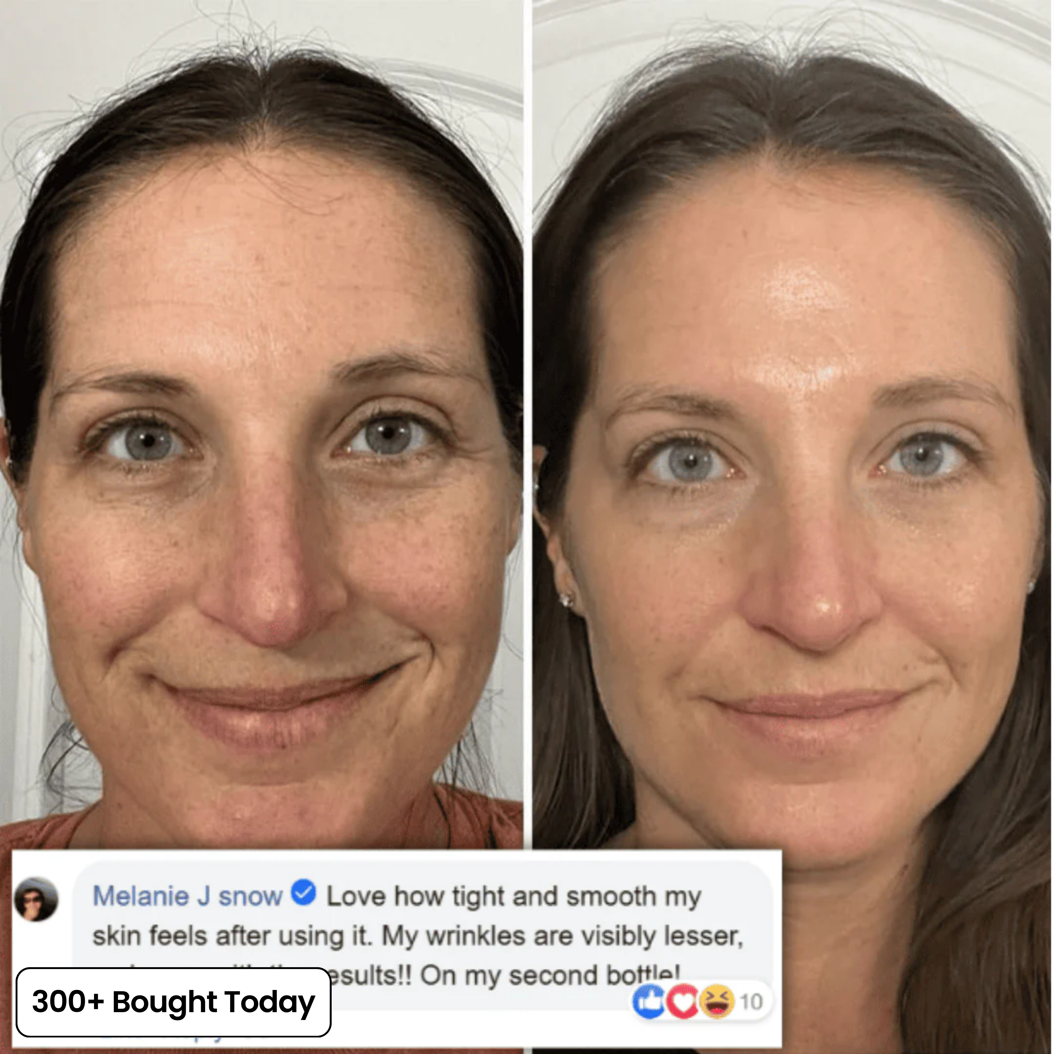 Wrinkle Smoothing Care – Youthful Glow Boost